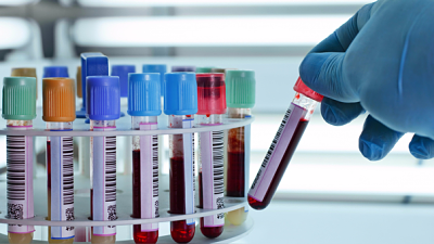 Laboratorio y Banco de Sangre